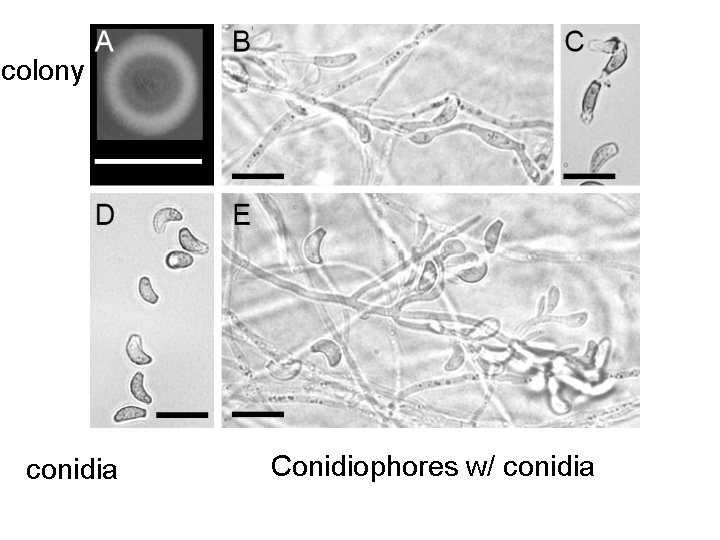 colony conidia Conidiophores w/ conidia 