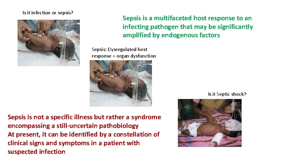Is it infection or sepsis? Sepsis is a multifaceted host response to an infecting Is it infection or sepsis? Sepsis is a multifaceted host response to an infecting