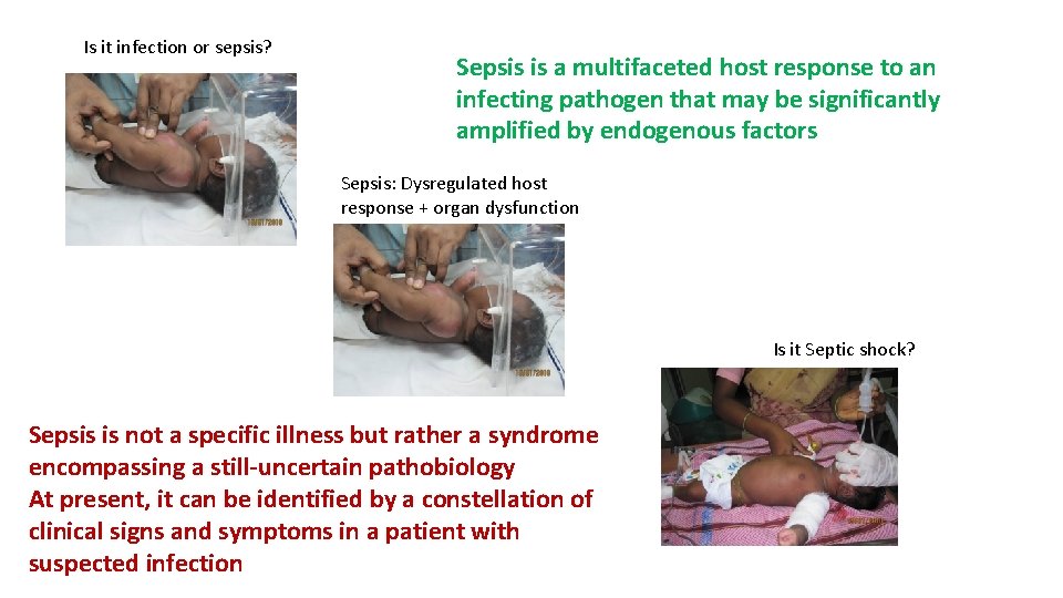 Is it infection or sepsis? Sepsis is a multifaceted host response to an infecting