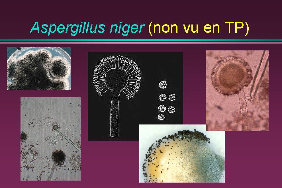 Aspergillus niger (non vu en TP) 