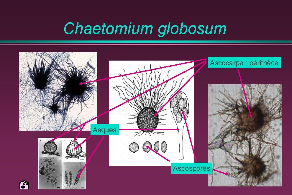 Chaetomium globosum Ascocarpe : périthèce Asques Ascospores 