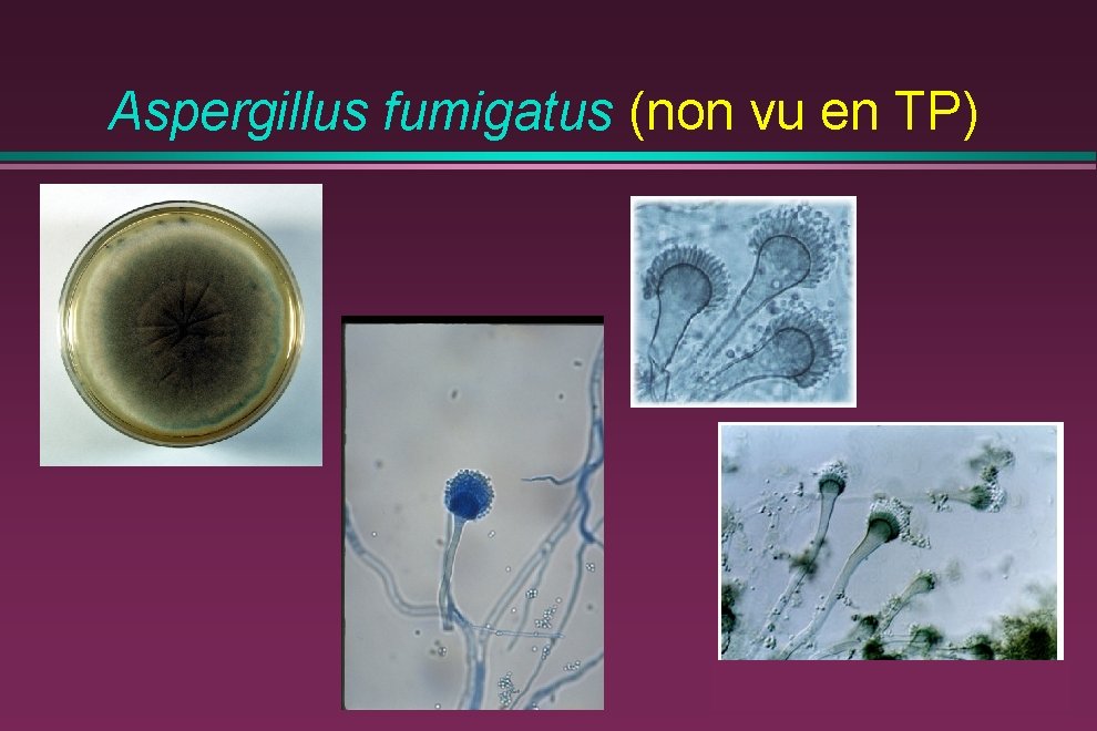 Aspergillus fumigatus (non vu en TP) 