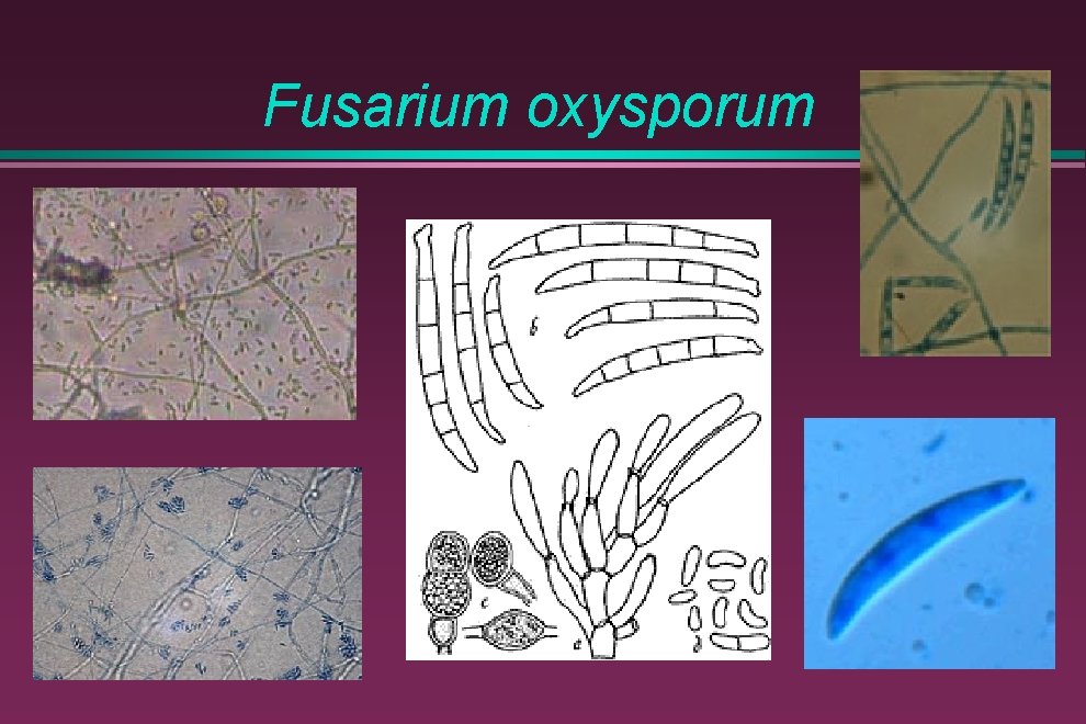 Fusarium oxysporum 