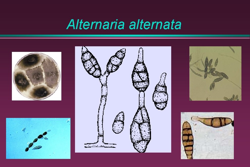 Alternaria alternata 