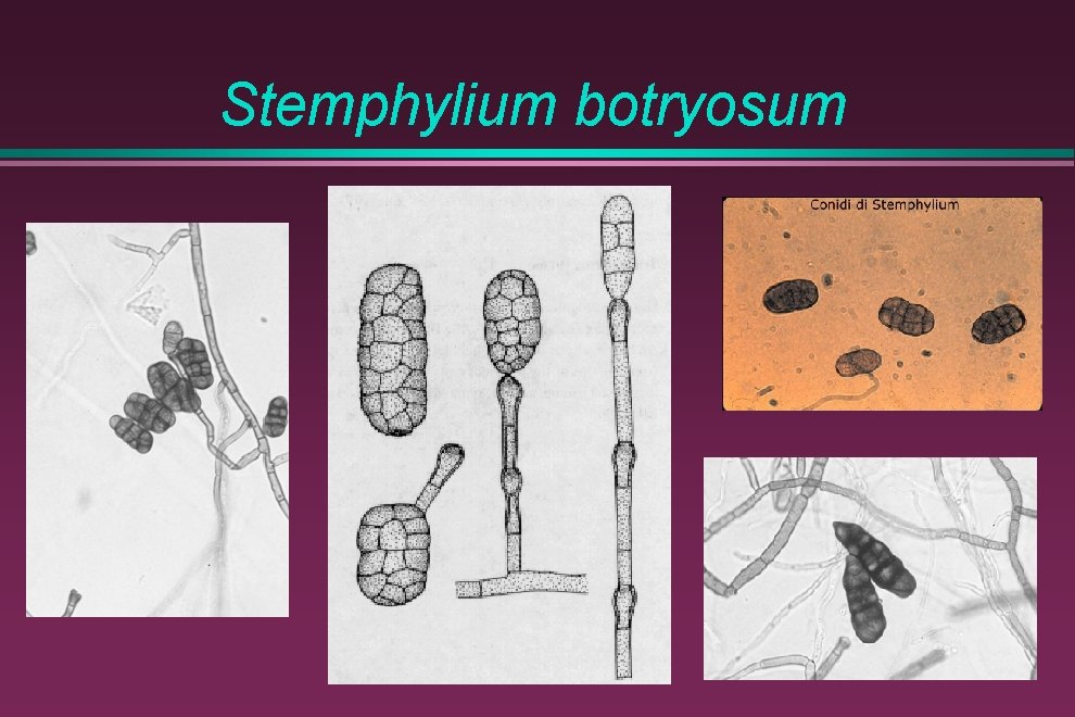 Stemphylium botryosum 