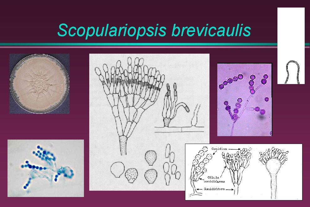 Scopulariopsis brevicaulis 