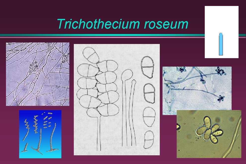 Trichothecium roseum 