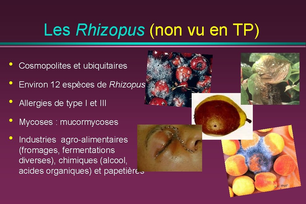 Les Rhizopus (non vu en TP) • • • Cosmopolites et ubiquitaires Environ 12