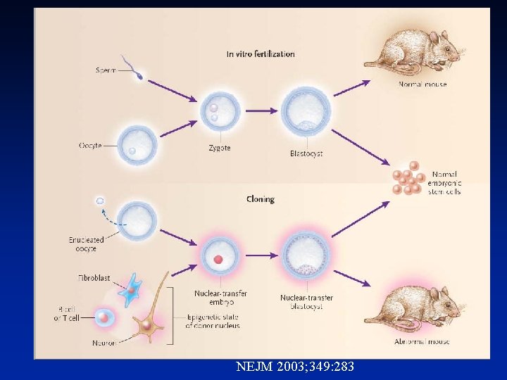 NEJM 2003; 349: 283 