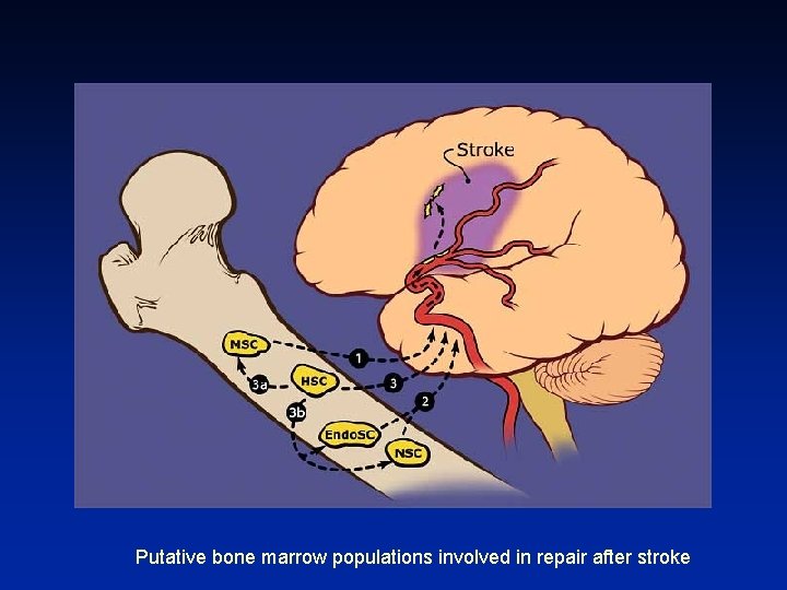  Putative bone marrow populations involved in repair after stroke 