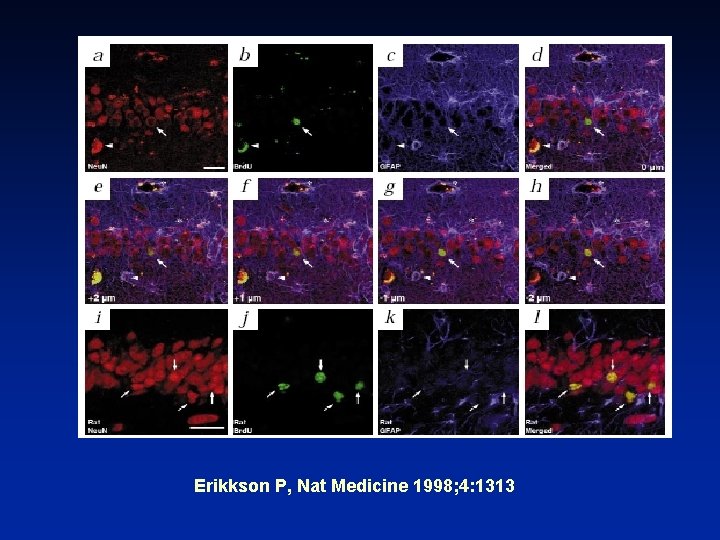 Erikkson P, Nat Medicine 1998; 4: 1313 