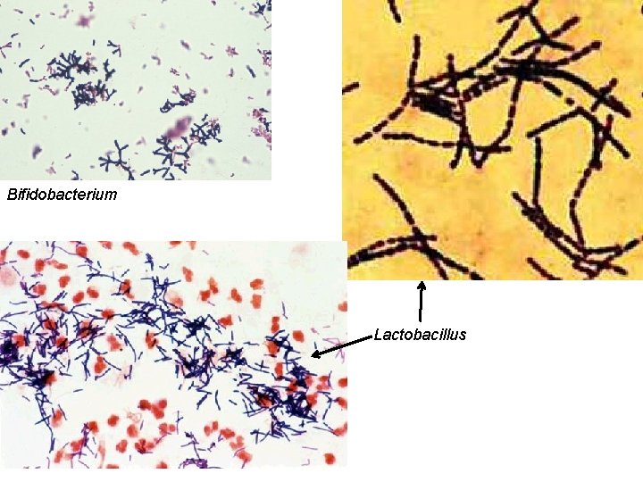 Bifidobacterium Lactobacillus 