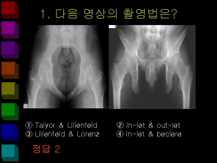 1. 다음 영상의 촬영법은? ① Talyor ＆ Lilienfeld ③ Lilienfeld ＆ Lorenz 정답 2