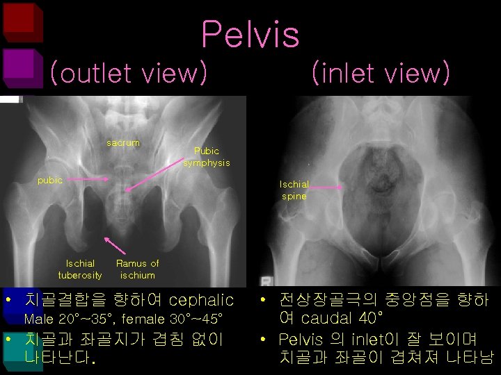 Pelvis (outlet view) sacrum Pubic symphysis pubic Ischial tuberosity (inlet view) Ischial spine Ramus