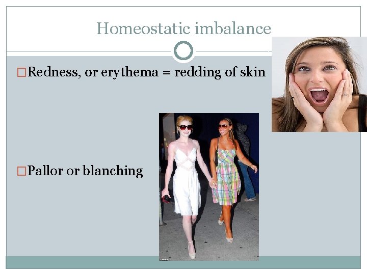 Homeostatic imbalance �Redness, or erythema = redding of skin �Pallor or blanching 