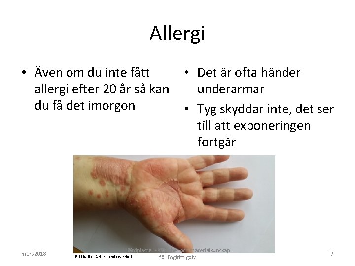 Allergi • Även om du inte fått • Det är ofta händer allergi efter