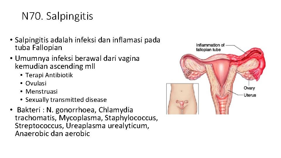 N 70. Salpingitis • Salpingitis adalah infeksi dan inflamasi pada tuba Fallopian • Umumnya