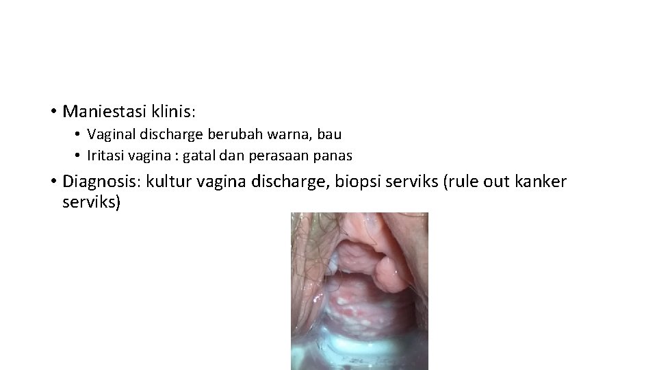  • Maniestasi klinis: • Vaginal discharge berubah warna, bau • Iritasi vagina :