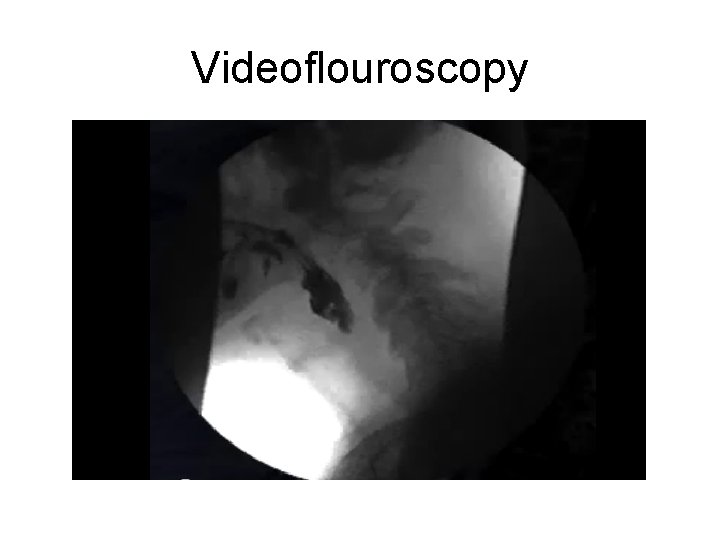 Videoflouroscopy 
