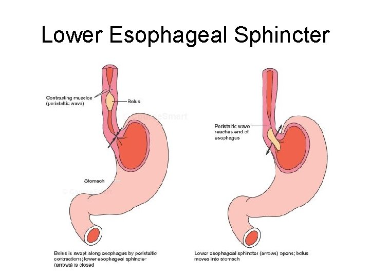 Lower Esophageal Sphincter Lower Esophageal Sphincter