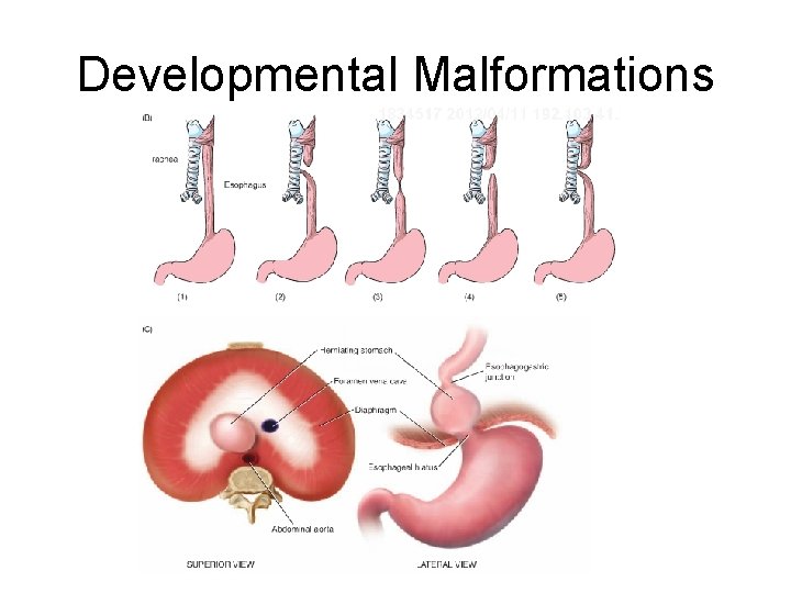 Developmental Malformations 