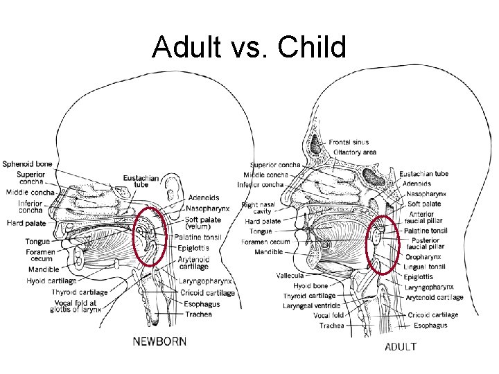 Adult vs. Child Adult vs. Child