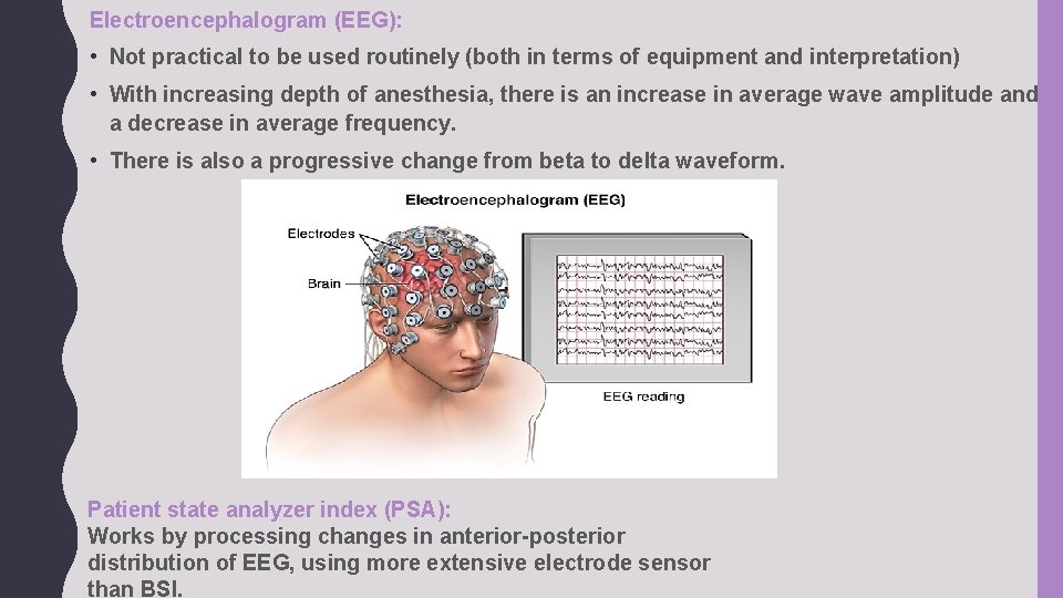 Electroencephalogram (EEG): • Not practical to be used routinely (both in terms of equipment