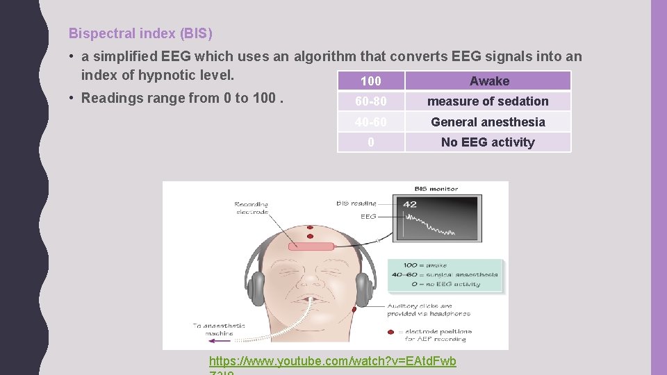 Bispectral index (BIS) • a simplified EEG which uses an algorithm that converts EEG