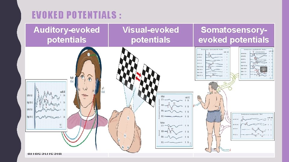 EVOKED POTENTIALS : Auditory-evoked potentials Visual-evoked potentials Somatosensoryevoked potentials Electrical activity passing from the
