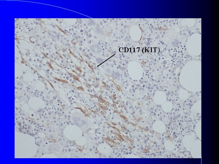 CD 117 (KIT) CD 117 (KIT)
