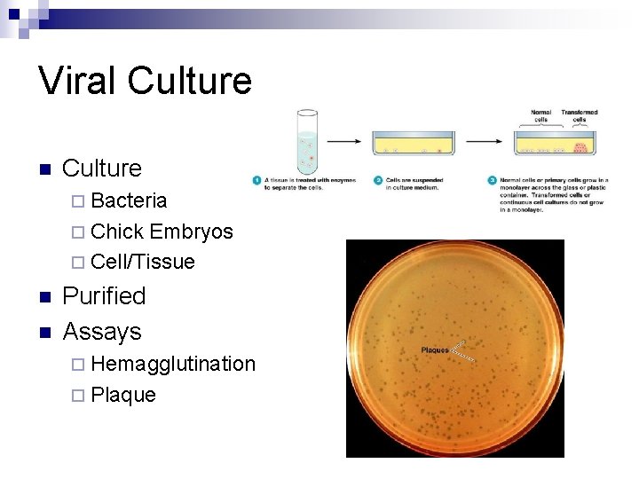 Viral Culture n Culture ¨ Bacteria ¨ Chick Embryos ¨ Cell/Tissue n n Purified