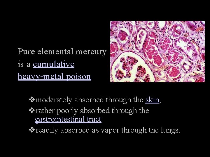 Pure elemental mercury is a cumulative heavy-metal poison vmoderately absorbed through the skin, vrather