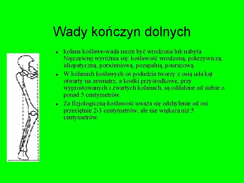 Wady kończyn dolnych kolana koślawe-wada może być wrodzona lub nabyta. Najczęściej wyróżnia się: koślawość