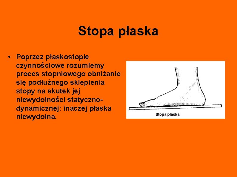 Stopa płaska • Poprzez płaskostopie czynnościowe rozumiemy proces stopniowego obniżanie się podłużnego sklepienia stopy
