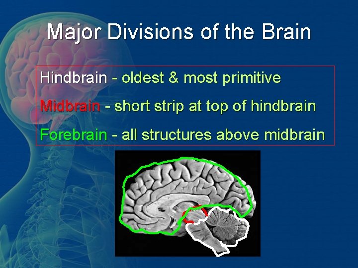 Major Divisions of the Brain Hindbrain - oldest & most primitive Midbrain - short Major Divisions of the Brain Hindbrain - oldest & most primitive Midbrain - short