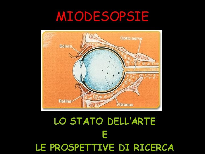 MIODESOPSIE LO STATO DELL’ARTE E LE PROSPETTIVE DI RICERCA 