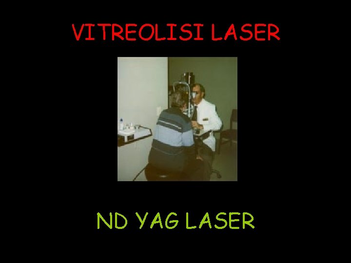 VITREOLISI LASER ND YAG LASER 