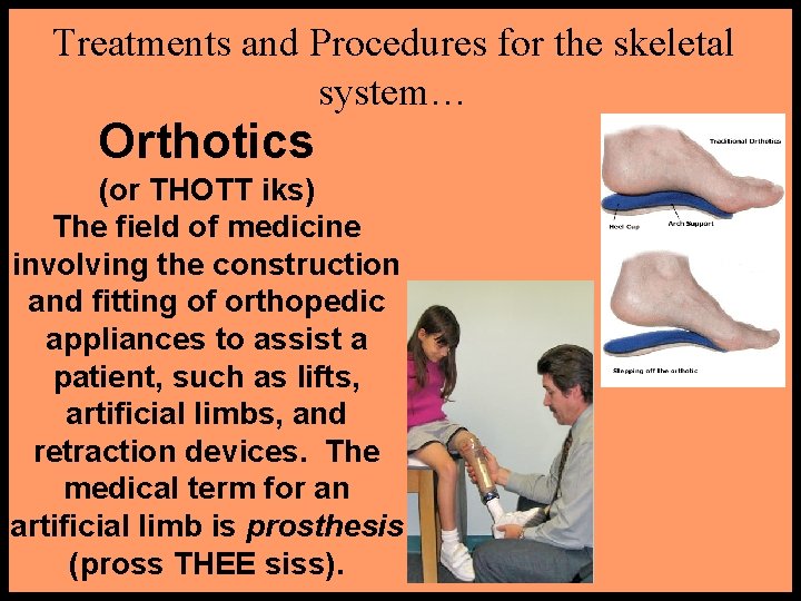 Treatments and Procedures for the skeletal system… Orthotics (or THOTT iks) The field of