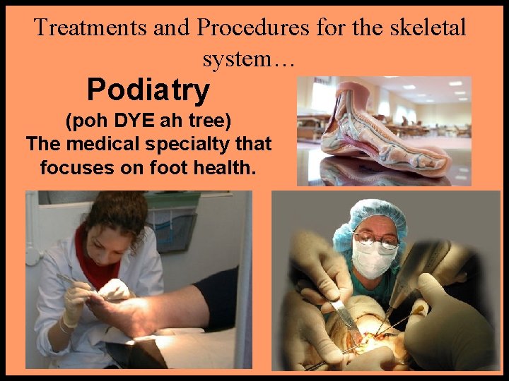 Treatments and Procedures for the skeletal system… Podiatry (poh DYE ah tree) The medical