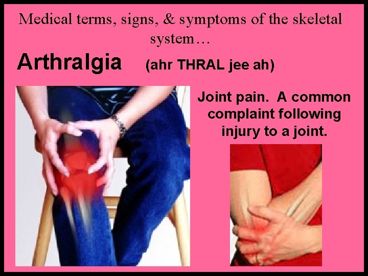 Medical terms, signs, & symptoms of the skeletal system… Arthralgia (ahr THRAL jee ah)