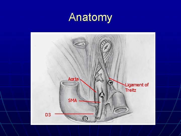Anatomy Aorta Ligament of Treitz SMA D 3 