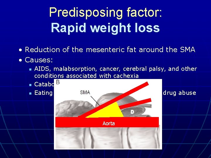 Predisposing factor: Rapid weight loss • Reduction of the mesenteric fat around the SMA