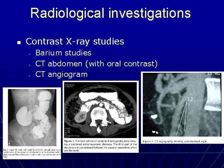 Radiological investigations n Contrast X-ray studies u u u Barium studies CT abdomen (with