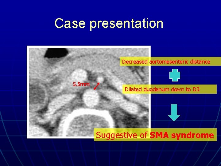 Case presentation Decreased aortomesenteric distance 5. 5 mm Dilated duodenum down to D 3