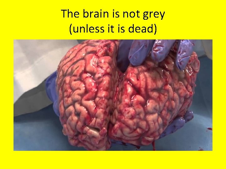 The brain is not grey (unless it is dead) 