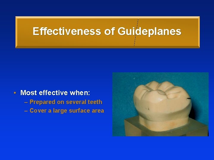 Effectiveness of Guideplanes • Most effective when: – Prepared on several teeth – Cover