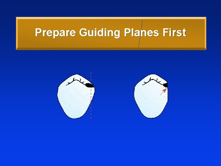 Prepare Guiding Planes First 