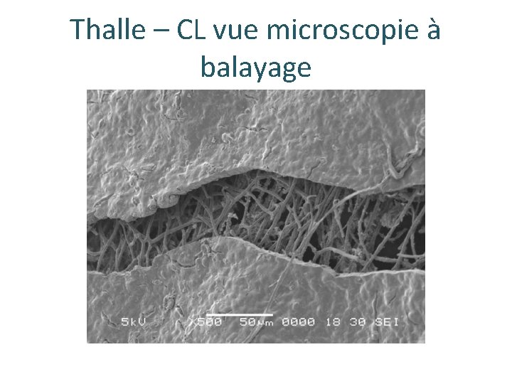 Thalle – CL vue microscopie à balayage 