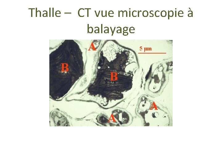 Thalle – CT vue microscopie à balayage 