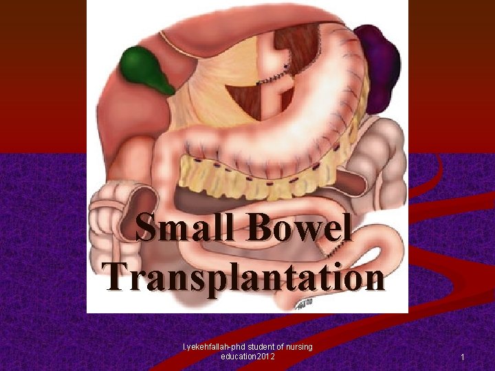 Small Bowel Transplantation l. yekehfallah-phd student of nursing education 2012 1 